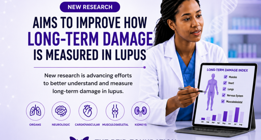 Research on measuring long-term damage in lupus